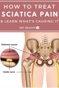 Sciatic Nerve Relief, Piriformis Muscle, Back Pain Remedies