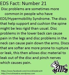 Elhers Danlos Syndrome, Ehlers Danlos Syndrome Hypermobility, Hollistic Health, Ehlers Danlos Syndrome Awareness, Mast Cell Activation Syndrome, Chiari Malformation, Ehlers Danlos Syndrome