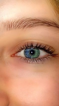 Heterochromia Eyes, Rare Eye Colors, Rare Eyes, Different Colored Eyes, Eye Pictures, Eye Photography