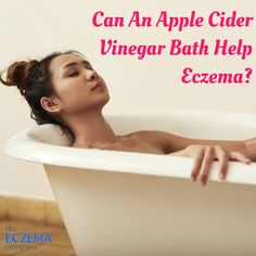 Can An Apple Cider Vinegar Bath Help Eczema? (Stop Bathing in Bleach) Stye Remedies, Eye Stye Remedies, Drinking Apple Cider Vinegar, Apple Cider Vinegar Acne, Apple Cider Vinegar Remedies, Apple Cider Vinegar Drink, Soothing Bath