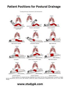 Mucus Clearing Techniques That Alleviate Shortness of Breath Postural Drainage Positions and Chest Physiotherapy (CPT) Study Guide Cardiopulmonary Physical Therapy, Respiratory Physiotherapy, Postural Drainage, Flail Chest, Respiratory Therapist Student, Physical Therapy School, Physical Therapy Student, Physical Therapist Assistant, Physical Therapy Assistant