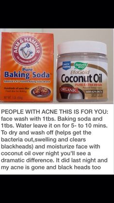 Baking Soda Coconut Oil, Obličejové Masky, Acne Help, Diy Acne, Homemade Oil, Natural Acne, Home Remedies For Acne, Acne Remedies, Skin Remedies