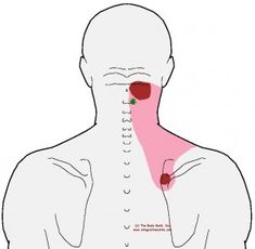 Punkty Spustowe, Neck And Shoulder Exercises, Stiff Neck, Neck Pain Relief, Neck And Shoulder Pain, Trigger Points, Body Pain, Shoulder Pain, Muscle Pain