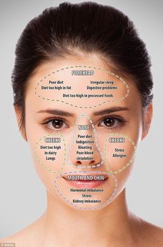 Generated Description with relevant hashtags. Acne Chart, Face Acne, Acne Remedies, Acne Skin, Chinese Medicine