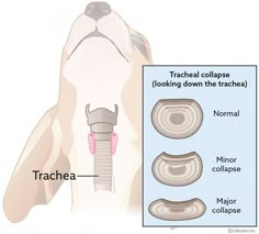 a diagram shows the location of traches and their corresponding attachments in which they are located