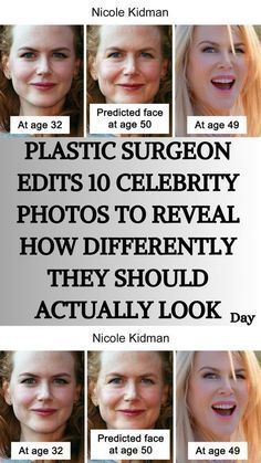 Bad Celebrity Plastic Surgery, Skincare Aesthetics, Face Surgery, Mommy Makeover