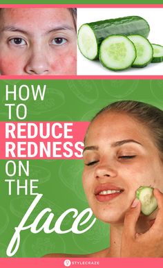 What To Use To Remove Dark Spots Red Spots On Face, Redness Remedy, Reduce Face Redness, Redness On Face, Carrot Cake Recipes, Crystal Makeup, Natural Sleep Remedies, Spots On Face, Skin Tags