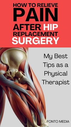 Why is there so Much Pain After Hip Replacement surgery? What you can do? Natural remedies? Exercices? Recovery Time? My best tips as a physical therapist! #HipSurgery #HipReplacement #PainRelief Hip Impingement Exercises, Hip Impingement, Knee Surgery Recovery, My Knee Hurts, Bursitis Hip, Therapy Exercises