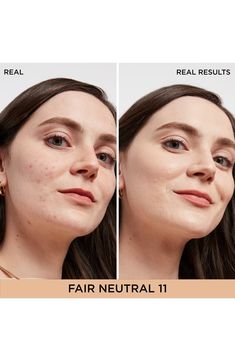 What it is: An all-in-one dark-spot concealer and serum that provides buildable coverage to instantly improve the look of dark spots and other skin concerns.Who it's for: Ideal for all skin types. Suitable for sensitive skin.What it does: The formula provides medium buildable coverage and can be used all over or as a spot concealer on areas you wish to brighten or conceal. How to use: To conceal dark spots: choose a shade that best matches skin around the dark spots that you are trying to concea Conceal Dark Spots, Spot Concealer, Concealer Brush, Stippling, Bye Bye, Dark Spots