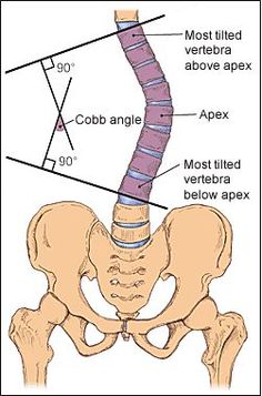 Radiology Student, Bone Grafting, Spinal Surgery, Radiology Imaging, Spinal Injury, Exercise Physiology, Primary Care Physician, Medical Facts