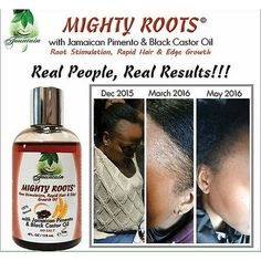 Buy Jamaican Black Castor & Pimento Mighty Roots Edge Growth Oil/Satin Cap 4ozDo you need to restore, renew or grow back your thinning hair or non-existent edges and hair line??If, so then you need Fountain Mighty Roots, a revolutionary conditioning and nourishing treatment that will rapidly grow back your hairFountain Mighty Roots 4 oz is an organic deep nourishing root & scalp oil rich in vitamins, minerals and essential fatty acidsAll natural, organic ingredients nurtured in Jamaica and bottl Edge Growth, Products For Hair Growth, Natural Hair Care Regimen, Castor Oil Hair, Thickening Hair, Products For Hair, Hair Growth Products, Hair Care Regimen, Jamaican Black Castor Oil