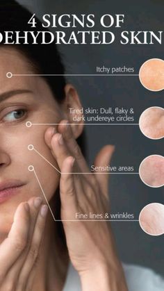 Signs Of Sensitive Skin, Skin Care Education, Dehydrated Skin Face, Skin Content Ideas, Skin Care Marketing, Skin Education, Beauty Education, Skin Dehydration, Glow Your Skin