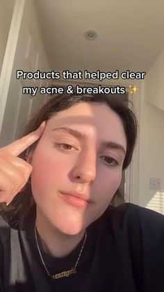 Clear Acne Fast, Lightening Dark Spots, Oatmeal Mask, Diy Oatmeal, Get Clear Skin, Lotion For Oily Skin, Tips For Oily Skin, Oily Skin Acne, Anti Wrinkle Skin Care