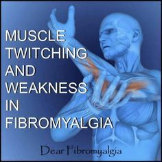 Muscle Twitching, Muscle Weakness, Muscles In Your Body, Muscle Contraction, Chronic Disease