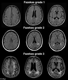 multiple mri images showing different areas of the brain and their corresponding functions in each area