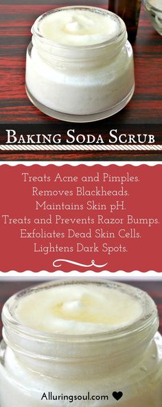 Baking Soda Scrub, Obličejové Masky, Health Coconut Oil, Coconut Oil Uses, Razor Bumps, Scrub Recipe, Acne Remedies, Remove Acne