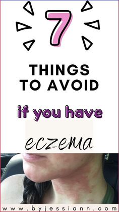 Everyone tells you what to do to heal excema but no one talks about what you should STOP doing as eczema remedies. These excema healing tips are from a firsthand eczema sufferer (me!) including more tips on how I cured severe eczema. Acne Inversa, Things To Stop Doing, Diy Wellness, Healing Tips, Acne Solutions, Morning Skin Care Routine, Table Designs, Cystic Acne