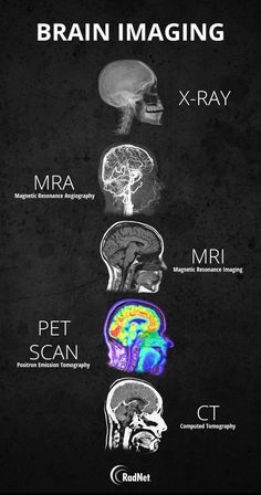 the brain is shown with different types of mris and their functions in each region