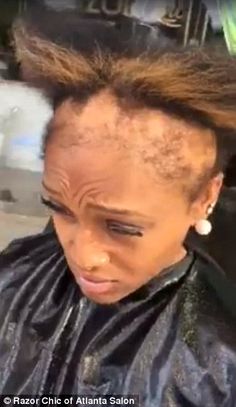 Atlanta hairstylist shares videos of clients suffering from hair loss due to weaves Hair Shedding Remedies, Natural Hair Growth Remedies, Male Pattern Baldness, Hair Remedies For Growth, Hairstyle Ideas, A Video