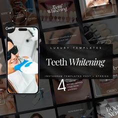 50 Teeth Whitening Instagram Templates | Professional Teeth Whitening Instagram Templates | Teeth Whitening Posts | Teeth Whitening Social Media Post Template What you get: 🦷50 Post Templates 🦷50 Matching Stories Templates 🦷1 PDF with very detailed instructions for how to use canva ( you need an account that is free) DISCLAIMER :  matching stories = same content as the post but every element / text is re-sized to fit the story format  How it Works: 🔥You purchase the template. 🔥 Once Etsy co Story Format, Social Media Post Template, Change Background, Social Media Templates, Story Template, Post Templates, Instagram Template, Social Media Template, Media Post