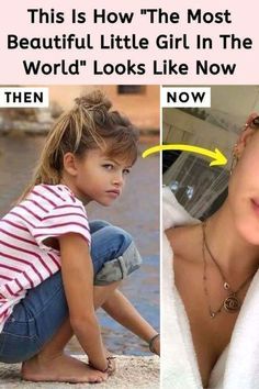 Thylane Blondeau, Loreal Paris, Plastic Surgery, Funny Facts, Fall Outfits, Most Beautiful, Celebrities, Memes