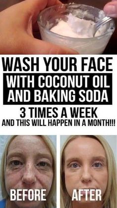 Coconut Oil Face Wash, Baking Soda Face Scrub, Coconut Oil And Baking Soda, Oil Face Wash, Baking Soda Coconut Oil, Baking Soda Face, Coconut Oil For Face, Skin Care Wrinkles