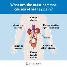 Kidney pain is felt in your sides, back, belly or groin. It’s often mistaken for back pain. Kidney pain can be caused by kidney stones, kidney infection, an injury or kidney cancer. Kidney pain treatment depends on the underlying cause. Blood Test Results, Kidney Pain, Urinary Tract, Medical Illustration, Blood Test, A Doctor