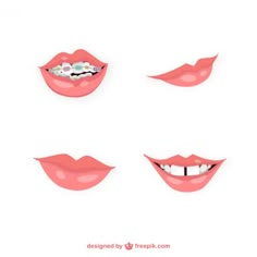 four different types of lips with braces and teethhades on top of each other