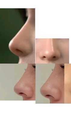 Slim Nose Front View, Nose Job Front Profile, Round Button Nose, Snub Nose Shape, Nose Manifestation, Ideal Face Subliminal, Nose Job Inspiration Natural, Ideal Nose