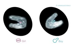 two different images of the same person's stomach and chest, one with an x - ray