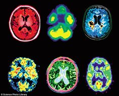 four different types of brain images in various colors and sizes, with one showing the location of