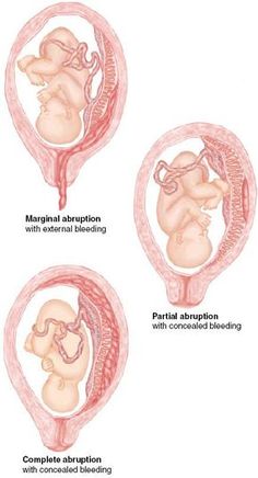 three stages of fetusing in the stomach