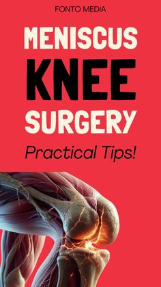 You have just undergone meniscus knee surgery, and you have many questions about the recovery time?  Or, you are gathering information before considering knee arthroscopy for  meniscus issues, or as a healthcare professional seeking better ways to support your patients? Meniscus Repair Surgery Recovery, Torn Knee Meniscus, Meniscus Surgery Recovery, Knee Exercises After Meniscus Surgery, Kinesio Taping Knee Meniscus, Arthroscopic Knee Surgery, Preparing For Knee Replacement Surgery, Knee Meniscus