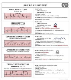 an info sheet describing the different types of medical devices and their functions in each region