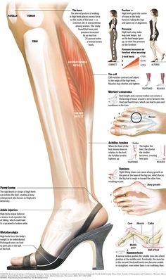 High Heel Effect On Body Health Info, Massage Therapy, Body Health, Physical Therapy, Healthy Tips, Womens Health, Back Pain, Yoga Poses, High Heel Shoes