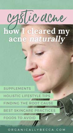 Clear Acne Naturally, Diet Products, I Healed, Oil Cleansing Method, Facial Face, Oil Cleansing, Prevent Pimples