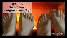 What is Small Fiber Neuropathy Tingling Hands, Autoimmune Disorders, Complex Regional Pain Syndrome, Autoimmune Disorder, Get My Life Together, Best Supplements, Invisible Illness, Foot Pain, Chronic Illness