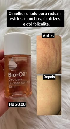 Moving To Italy, Bio Oil, Living In Italy, Skin Care Spa, Healthy Skin Tips, Girl Tips, American Woman, Body Skin Care Routine, Skin Tips