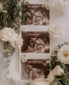 two x - ray images sitting next to white flowers