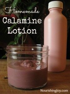 Homemade Calamine Lotion, Calamine Lotion, Healing Salves, Homemade Lotion, Natural Home Remedies