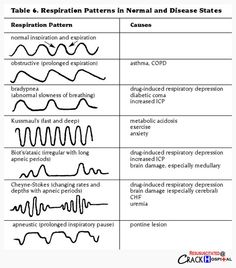 two diagrams showing the different types of normal and non - dissentifiable patterns