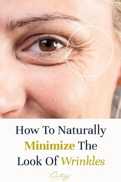 HOW TO NATURAL MINIMIZE THE LOOK OF WRINKLE Kashi Vishwanath, Wrinkle Filler, In My 20s, Neck Wrinkles