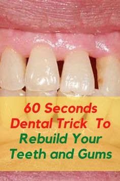 60 Seconds Dental Trick To rebuild Teeth and Gums, rebuild teeth and gums naturally heal teeth and gums naturally Tooth Decay Remedies, Teeth Health, Oral Care Routine, Gum Care, Receding Gums, Gum Health, Dental Problems, Oral Health Care, Teeth Care