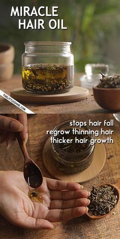 Miracle Hair Growth, Regrow Thinning Hair, Thicker Stronger Hair, Regrow Hair Naturally, Grow Thicker Hair, Thick Hair Growth, Stop Hair Breakage