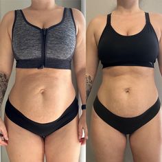 before and after photos of a woman's tummy surgery