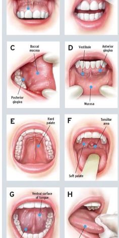 #Dental_Assistant_School #Dental_Assistant_Study #Dental_World #Kedokteran_Gigi Dental Hygienist School, Dental Hygiene Student, Dental World, Kedokteran Gigi