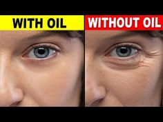 (3667) 9 Oils That Will Fight Wrinkles And Give You Youthful Skin - YouTube Essential Oils For Wrinkles, Oils For Wrinkles, Wrinkles Remedies, Wrinkles Remedies Face, Pressure Point Therapy, Face Cream For Wrinkles, Facial Oils, Face Oils, Skin Care Routine Order