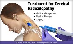 Symptom of cervical radiculopathy is pain that spreads into the neck, chest, arm, and/or shoulders. Common surgeries for cervical radiculopathy are anterior cervical discectomy and anterior cervical fusion. Physical Therapy may include heat, ultrasound, massage, electrical stimulation, stretching, gentle cervical traction and mobilization. Cervical Fusion, Erbs Palsy, Neck Spasms, Healing Exercises, Cervical Traction, Psoas Muscle