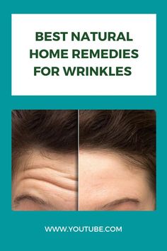 BEST NATURAL HOME REMEDIES FOR WRINKLES