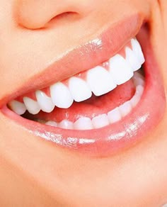 Natural Teeth Whitening Diy, Teeth Whitening Toothpaste, Charcoal Teeth Whitening, 얼굴 그리기